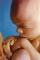 Fetus 5 months 40 x 60