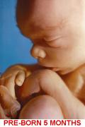 Fetus 5 months captioned 120 x 180