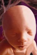 Fetus 6 months 120 x 179