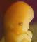 Fetus 7 weeks 53x60