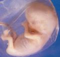 Fetus 8 weeks 120 x 114