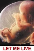 Fetus: LET ME LIVE 120 x 180