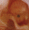 Young Fetus59x60